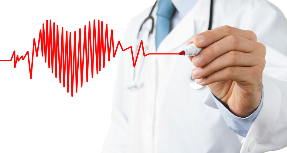A doctor drawing the heart rhythms of the heart showing atrial fibrillation