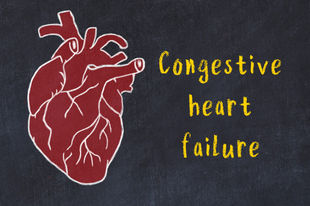 heart with congestive heart failure
