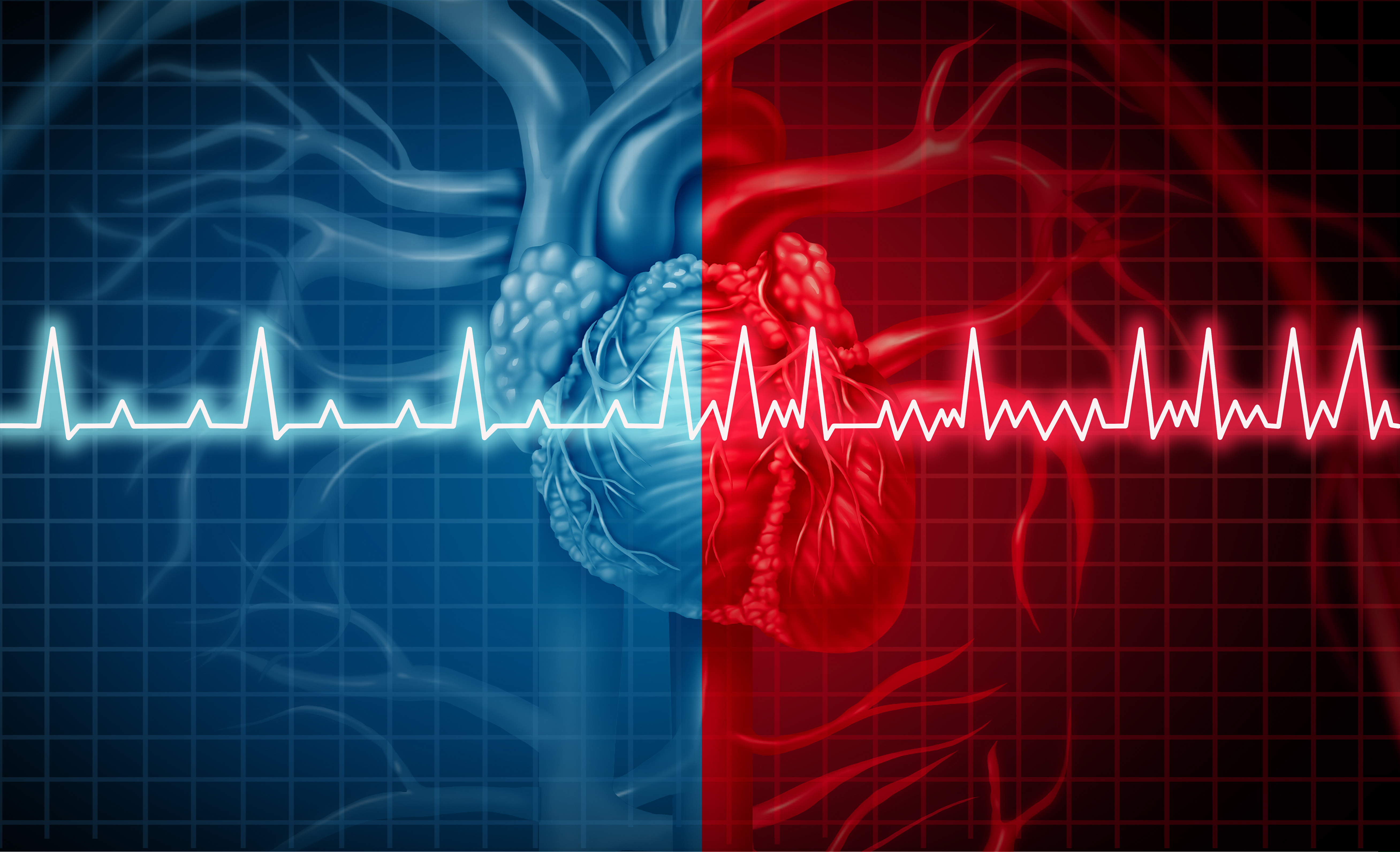 Types of Heart Disease Pulse Cardiology